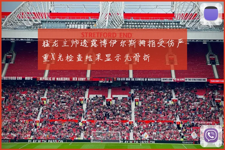 猛龙主帅透露博伊尔斯拇指受伤严重X光检查结果显示无骨折